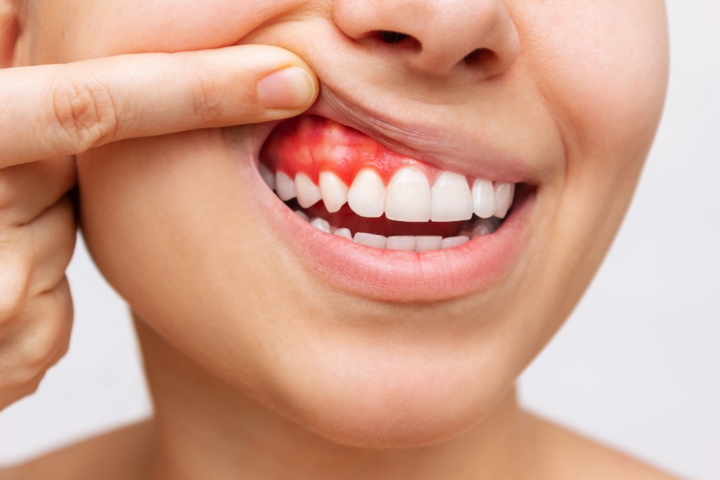 Periodontia